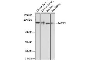 Western blot analysis of extracts of various cell lines, using L Rabbit mAb  at 1:1000 dilution. (LAMP2 antibody)