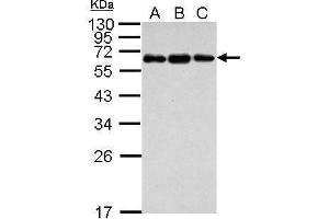 WB Image Sample (30 ug of whole cell lysate) A: Jurkat B: Raji C: K562 12% SDS PAGE antibody diluted at 1:1000 (C4BPB antibody)