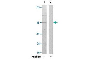 Western blot analysis of extracts from HepG2 cells, using AZI2 polyclonal antibody .