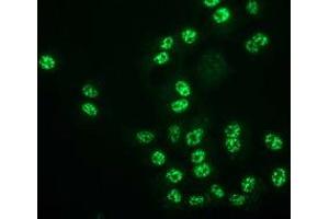 Anti-MGLL mouse monoclonal antibody (ABIN2454694) immunofluorescent staining of COS7 cells transiently transfected by pCMV6-ENTRY MGLL (RC218358). (MGLL antibody)