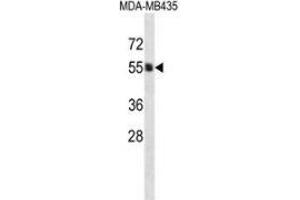 Western blot analysis in MDA-MB435 cell line lysates (35ug/lane) using PIGA  Antibody . (PIGA antibody  (C-Term))