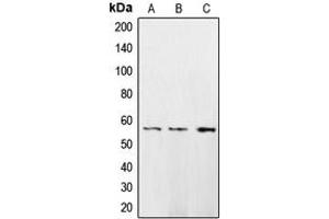 Western blot analysis of CaMK2 delta expression in HeLa (A), A431 (B), H1299 (C) whole cell lysates.