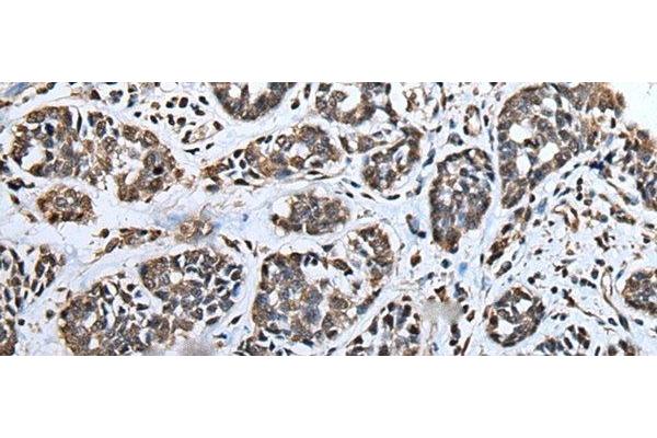 ATAD1 antibody