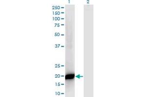PPP1R14B antibody  (AA 64-139)