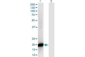 PPP1R14B antibody  (AA 64-139)