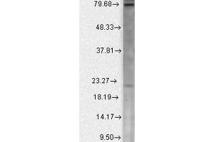 Western Blot analysis of Human Cell line lysates showing detection of Cav Beta2 Calcium Channel protein using Mouse Anti-Cav Beta2 Calcium Channel Monoclonal Antibody, Clone S8b-1 .