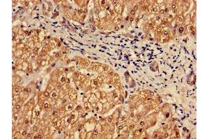 Immunohistochemistry (IHC) image for anti-Proteasome Subunit alpha  7 (PSMA7) (AA 5-232) antibody (ABIN7164964)