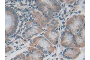 DAB staining on IHC-P; Samples: Human Stomach Tissue (IL20RB antibody  (AA 37-290))