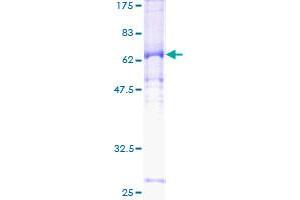 Image no. 1 for Cyclin E2 (CCNE2) (AA 1-374) protein (GST tag) (ABIN1348463)