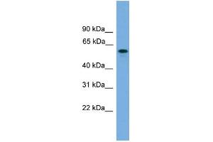 WB Suggested Anti-KIAA1609 Antibody Titration: 0. (KIAA1609 antibody  (Middle Region))