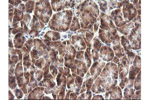 Image no. 2 for anti-Interleukin 1 Family Member 9 (IL1F9) antibody (ABIN1498873) (IL1F9 antibody)