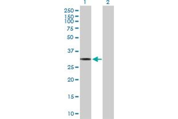 MTFMT antibody  (AA 1-304)