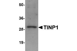 Western Blotting (WB) image for anti-NSA2 Ribosome Biogenesis Homolog (NSA2) (C-Term) antibody (ABIN1030737) (NSA2 antibody  (C-Term))