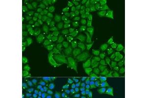 Immunofluorescence analysis of U2OS cells using ATPIF1 Polyclonal Antibody at dilution of 1:100. (ATPase Inhibitory Factor 1 antibody)