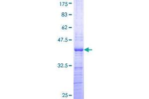 PHF21A Protein (AA 331-430) (GST tag)