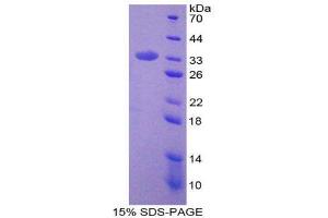 SDS-PAGE (SDS) image for Prolylcarboxypeptidase (PRCP) (AA 108-376) protein (His tag) (ABIN2126432)