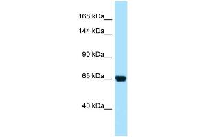 WB Suggested Anti-PALB2 AntibodyTitration: 1. (PALB2 antibody  (N-Term))