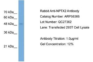 WB Suggested Anti-NPTX2  Antibody Titration: 0. (NPTX2 antibody  (Middle Region))