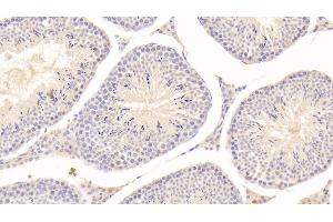 Detection of GLb in Mouse Testis Tissue using Polyclonal Antibody to Galactosidase Beta (GLb) (GLB1 antibody  (AA 192-432))