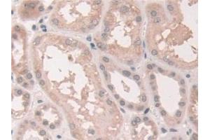 Immunohistochemistry (IHC) image for anti-Nuclear Receptor Coactivator 3 (NCOA3) (AA 1023-1304) antibody (ABIN7441217)