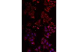Immunofluorescence analysis of U2OS cells using NCR1 antibody (ABIN5973838). (NCR1 antibody)