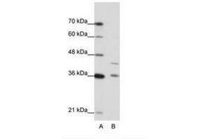 Image no. 1 for anti-Naked Cuticle Homolog 2 (NKD2) (AA 43-92) antibody (ABIN6736218)