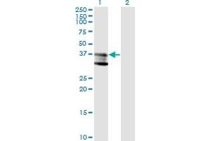 Western Blot analysis of SMPD1 expression in transfected 293T cell line by SMPD1 monoclonal antibody (M01), clone 4H2. (SMPD1 antibody  (AA 1-364))