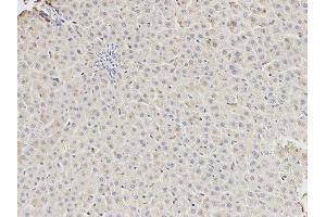 Immunohistochemistry (IHC) image for anti-DEAD (Asp-Glu-Ala-Asp) Box Polypeptide 5 (DDX5) antibody (ABIN1876484)