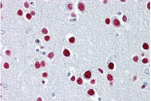 Immunohistochemistry with Brain, cortex tissue at an antibody concentration of 5µg/ml using anti-TUB antibody (ARP33467_P050) (TUB antibody  (N-Term))