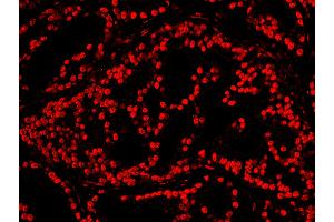 Immunofluorescence (IF) image for anti-cAMP Responsive Element Binding Protein 1 (CREB1) (AA 250-300) antibody (ABIN7448947) (CREB1 antibody  (AA 250-300))