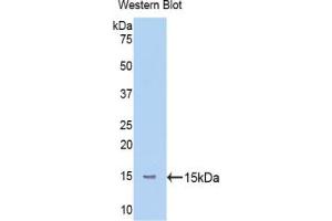 Western blot analysis of the recombinant protein. (Mannose Associated Serine Protease 2 (AA 170-287) antibody)