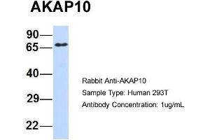 Host: Rabbit Target Name: AKAP10 Sample Type: 293T Antibody Dilution: 1. (AKAP10 antibody  (Middle Region))