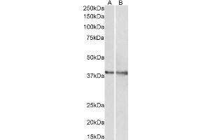 ABIN768559 (1µg/ml) staining of Rat (A) and Pig (B) Heart lysate (35µg protein in RIPA buffer). (IDH3G antibody  (AA 337-350))