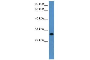 WB Suggested Anti-Cyb5r2 Antibody Titration: 0. (CYB5R2 antibody  (C-Term))