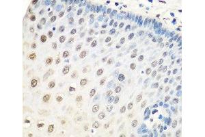 Immunohistochemistry of paraffin-embedded Human esophagus using HNRNPA0 Polyclonal Antibody at dilution of 1:100 (40x lens). (HNRNPA0 antibody)