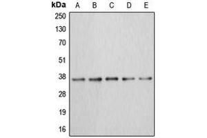 Western blot analysis of Annexin A3 expression in MCF7 (A), HEK293T (B), HepG2 (C), mouse kidney (D), rat liver (E) whole cell lysates. (Annexin A3 antibody  (Center))