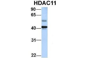 Host:  Rabbit  Target Name:  HDAC11  Sample Type:  Human Adult Placenta  Antibody Dilution:  1. (HDAC11 antibody  (Middle Region))