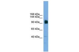 Image no. 1 for anti-Zinc Finger Protein 445 (ZNF445) (AA 601-650) antibody (ABIN6744636) (ZNF445 antibody  (AA 601-650))