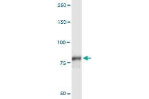 Immunoprecipitation of PLA2G6 transfected lysate using anti-PLA2G6 MaxPab rabbit polyclonal antibody and Protein A Magnetic Bead , and immunoblotted with PLA2G6 purified MaxPab mouse polyclonal antibody (B01P) . (PLA2G6 antibody  (AA 1-752))