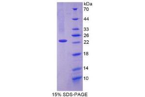 SDS-PAGE (SDS) image for SIVA1, Apoptosis-Inducing Factor (SIVA1) (AA 1-175) protein (His tag) (ABIN2124281)