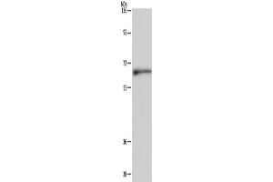 Western Blotting (WB) image for anti-Elastin (ELN) antibody (ABIN5543469) (Elastin antibody)