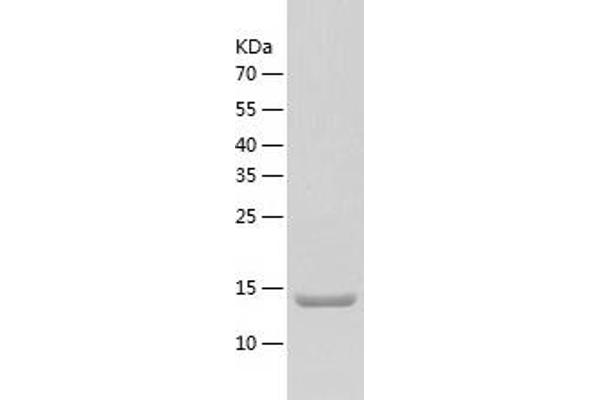 BLOC1S2 Protein (AA 1-142) (His tag)