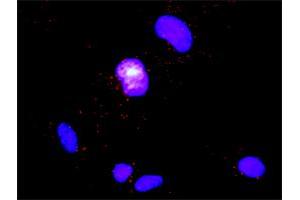 Proximity Ligation Analysis of protein-protein interactions between CD247 and DOCK2. (DOCK2 antibody  (AA 1-336))