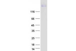 Validation with Western Blot (DCC Protein (Myc-DYKDDDDK Tag))