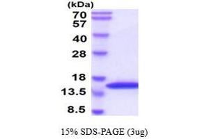 SDS-PAGE (SDS) image for Vesicle-Associated Membrane Protein 2 (Synaptobrevin 2) (VAMP2) (AA 1-89) protein (His tag) (ABIN667044)