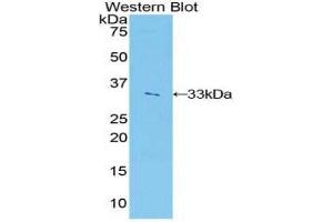 Western Blotting (WB) image for anti-Insulin-Like Growth Factor 2 mRNA Binding Protein 2 (IGF2BP2) (AA 293-557) antibody (ABIN1859296)