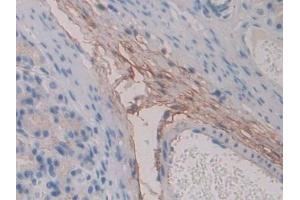 Detection of FBN1 in Rat Stomach Tissue using Polyclonal Antibody to Fibrillin 1 (FBN1) (Fibrillin 1 antibody  (AA 751-895))