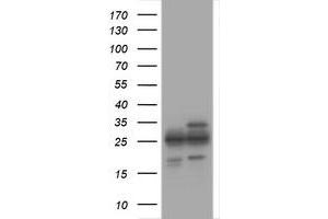 Image no. 1 for anti-Proteasome Subunit alpha 2 (PSMA2) (AA 50-234) antibody (ABIN1491570) (PSMA2 antibody  (AA 50-234))