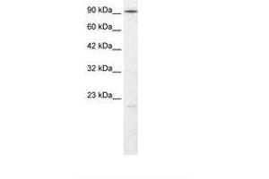 Image no. 2 for anti-Ligase IV, DNA, ATP-Dependent (LIG4) (AA 275-324) antibody (ABIN202951) (LIG4 antibody  (AA 275-324))