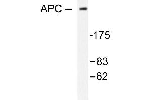 Image no. 1 for anti-Adenomatous Polyposis Coli (APC) antibody (ABIN265313) (APC antibody)